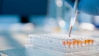 Close up of researcher preparing samples in lab using pipette.